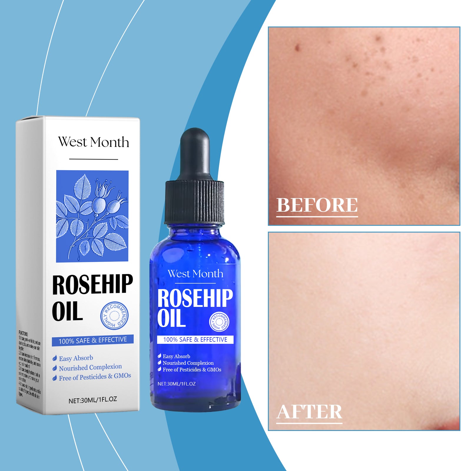 West Month Rose Hip Skin Care Essential Oil, Facial Moisturizing Moisturizing Firming Skin Tender Essence