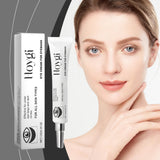 Hoygi Nicotinamide Eye Cream Gently Nourifies And Moisturizes Elastic Eye Skin Daily Care Hydrating Eye Cream